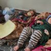 سرخک و اسهال جان صدها نفر را در افغانستان گرفته است
